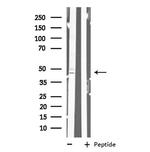 MAD2L1BP Antibody in Western Blot (WB)