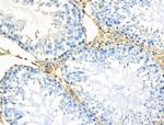 TOMM20 Antibody in Immunohistochemistry (Paraffin) (IHC (P))