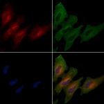 ME1 Antibody in Immunocytochemistry (ICC/IF)