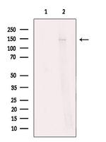 Neurocan Antibody in Western Blot (WB)