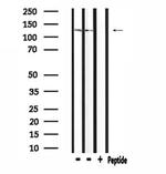 Neurocan Antibody in Western Blot (WB)