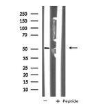 NUSAP1 Antibody in Western Blot (WB)