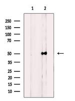 NUSAP1 Antibody in Western Blot (WB)