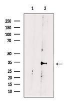 KCNK6 Antibody in Western Blot (WB)