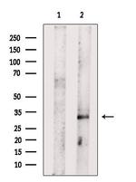 KCNK6 Antibody in Western Blot (WB)