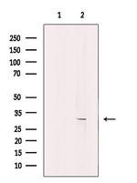 KCNK7 Antibody in Western Blot (WB)