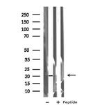 BTC Antibody in Western Blot (WB)