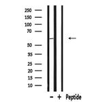 RAB11FIP2 Antibody in Western Blot (WB)