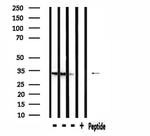 RAB40B Antibody in Western Blot (WB)