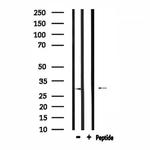 RAB29 Antibody in Western Blot (WB)