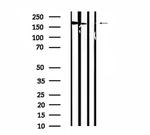 STK36 Antibody in Western Blot (WB)