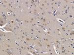 NIM1 Antibody in Immunohistochemistry (Paraffin) (IHC (P))