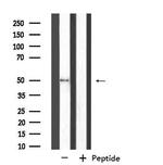 NIM1 Antibody in Western Blot (WB)