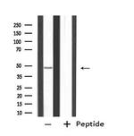 PPP2R2B Antibody in Western Blot (WB)