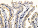 SH2D2A Antibody in Immunohistochemistry (Paraffin) (IHC (P))