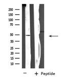 SH2D2A Antibody in Western Blot (WB)