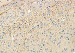 SCK Antibody in Immunohistochemistry (Paraffin) (IHC (P))