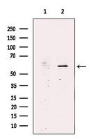 SCK Antibody in Western Blot (WB)