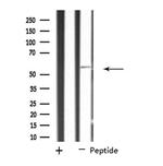 SCK Antibody in Western Blot (WB)