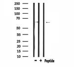 SLC6A1 Antibody in Western Blot (WB)