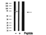 Dopamine Transporter Antibody in Western Blot (WB)