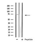 Dopamine Transporter Antibody in Western Blot (WB)