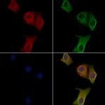 eIF2b gamma Antibody in Immunocytochemistry (ICC/IF)