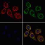 UBE2D2 Antibody in Immunocytochemistry (ICC/IF)