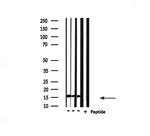 UBE2D2 Antibody in Western Blot (WB)