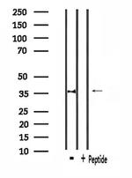 CACNG7 Antibody in Western Blot (WB)