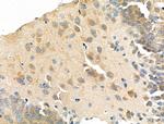 WASF3 Antibody in Immunohistochemistry (Paraffin) (IHC (P))