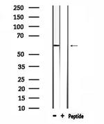 WASF3 Antibody in Western Blot (WB)