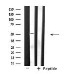 SLC39A7 Antibody in Western Blot (WB)