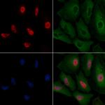 ALY Antibody in Immunocytochemistry (ICC/IF)