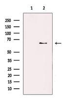 ZNF695 Antibody in Western Blot (WB)