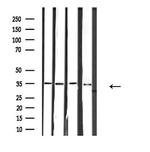 RNF113B Antibody in Western Blot (WB)