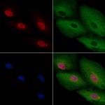 ARX Antibody in Immunocytochemistry (ICC/IF)