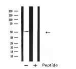 ARX Antibody in Western Blot (WB)