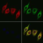 STARD10 Antibody in Immunocytochemistry (ICC/IF)