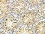 STARD10 Antibody in Immunohistochemistry (Paraffin) (IHC (P))