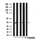 STARD10 Antibody in Western Blot (WB)