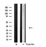 STARD10 Antibody in Western Blot (WB)