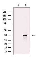 STARD10 Antibody in Western Blot (WB)