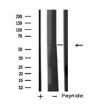 CYP11B1/CYP11B2 Antibody in Western Blot (WB)