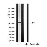 FGFR5 Antibody in Western Blot (WB)