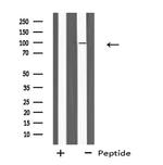 PLA2G6 Antibody in Western Blot (WB)