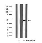 ZAR1 Antibody in Western Blot (WB)