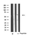 CYP26C1 Antibody in Western Blot (WB)