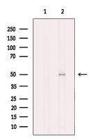 CK1 delta Antibody in Western Blot (WB)