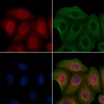 CK1 delta Antibody in Immunocytochemistry (ICC/IF)